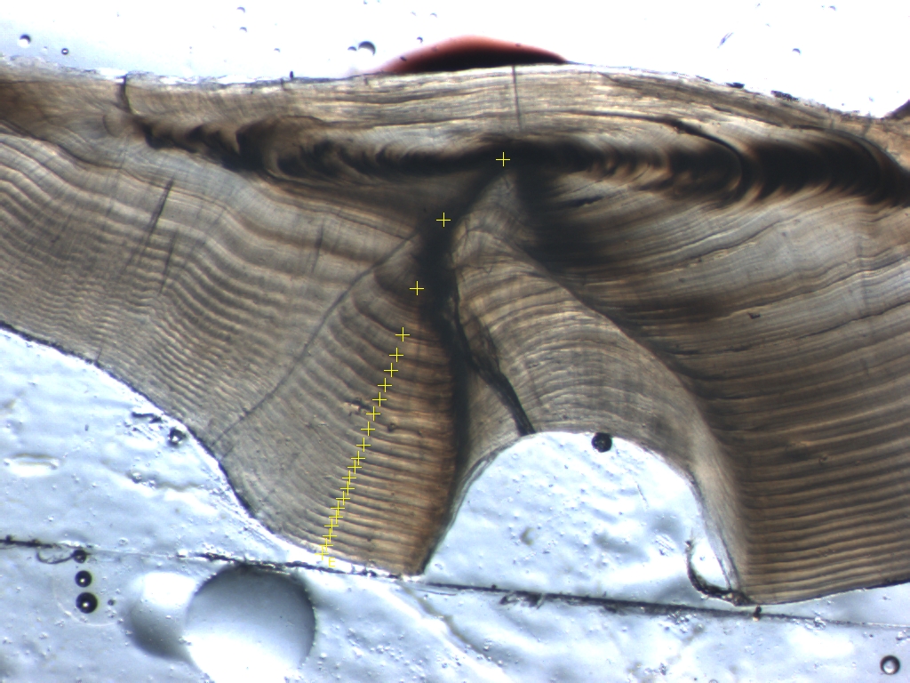 Yellow plus signs mark growth lines on this fish otolith, or ear bone; in this case the fish is 21 years old.