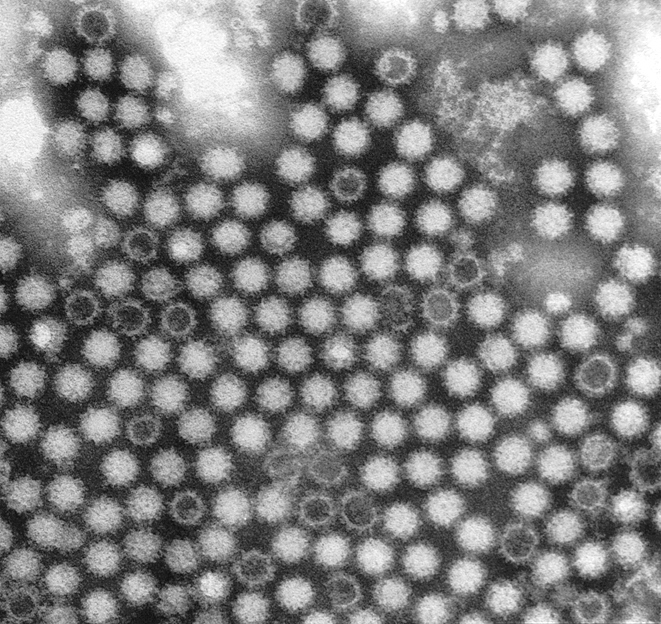 Rabbit calicivirus as seen by transmission electron micrograph (Photo: CSIRO)